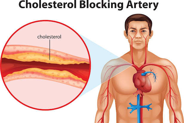 Tips To cholesterol : आपके नसों मे जमे कोलेस्ट्रॉल को निकाल फेकेंगे ये 5 सस्ते फल