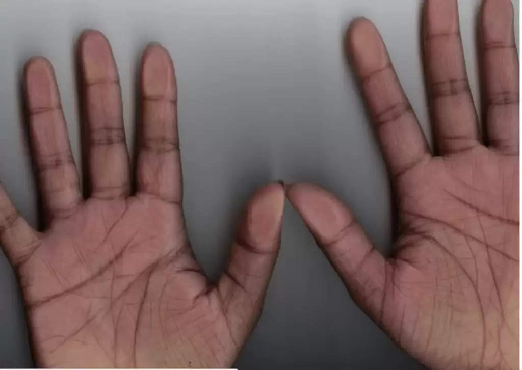 जानिये हाथों की लकीरों मैं छिपे M और X का राज़, ये रेखा अगर आप के हाथों मैं हैं तो आप है बेहद ख़ास